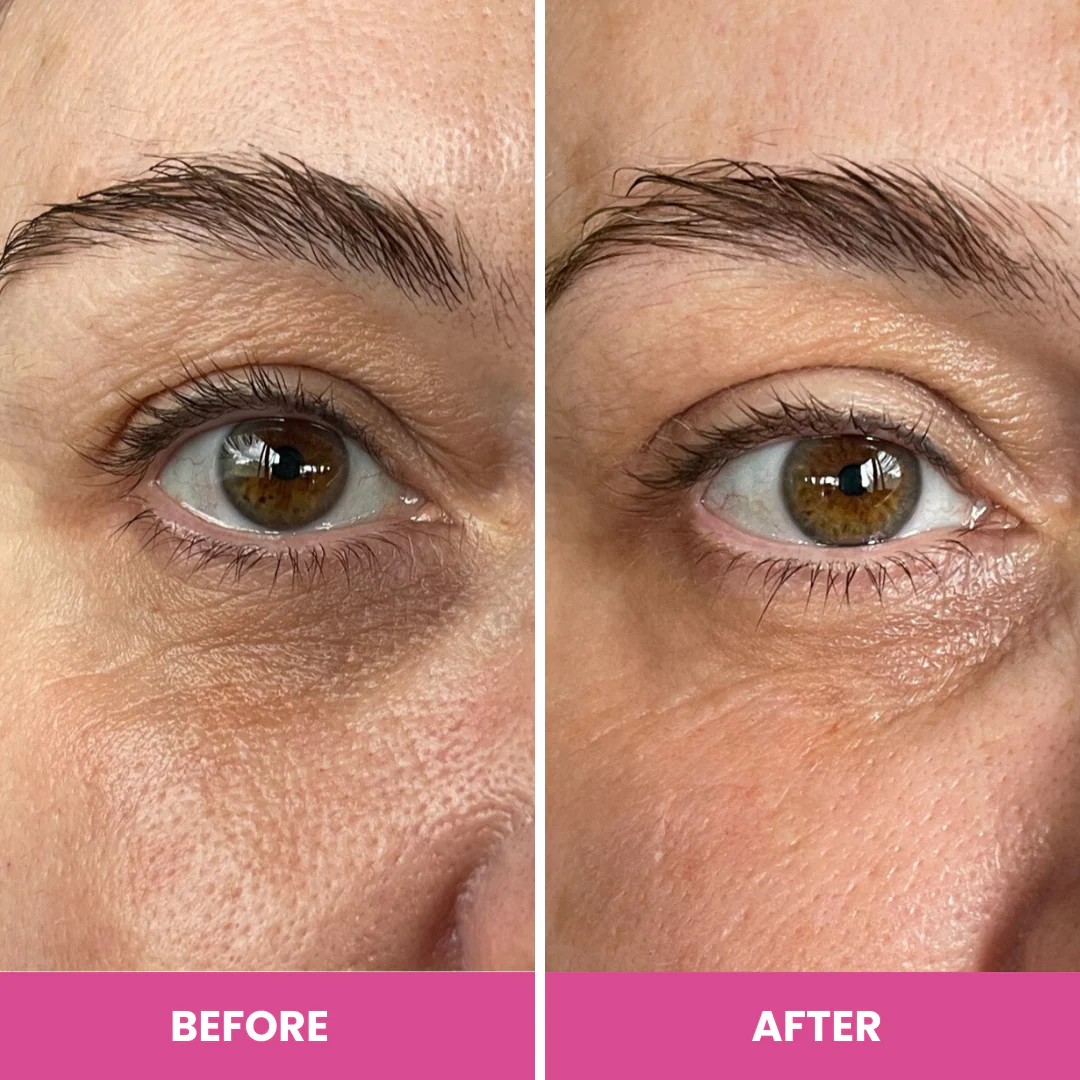 PrimeEyes Hydrate - Image 4