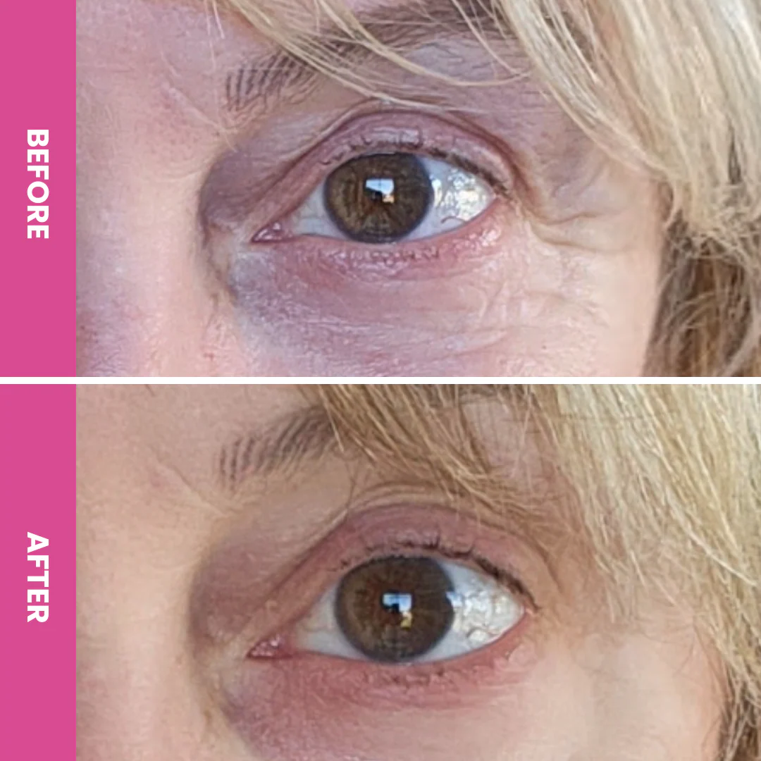 PrimeEyes Glide + PrimeEyes Hydrate Bundle - Image 3